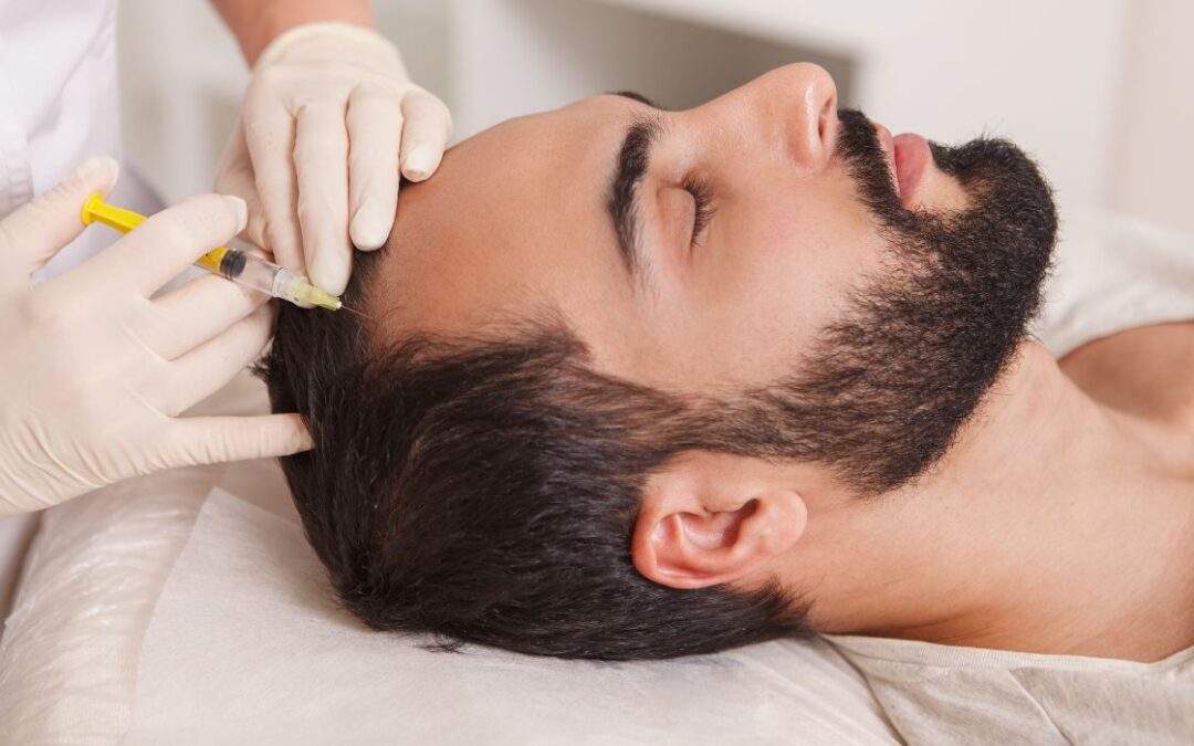 What is Hair Loss and What Causes it?